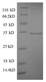 Human SDHA protein