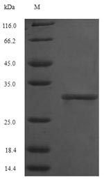 Human SDHA protein