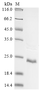 Human SLCO2B1 protein