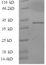 Human alpha Synuclein protein