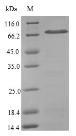 Human SRP54 protein