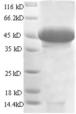 Human STC1 protein