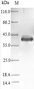 Human STC1 protein