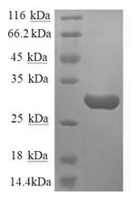 Human TACR1 protein