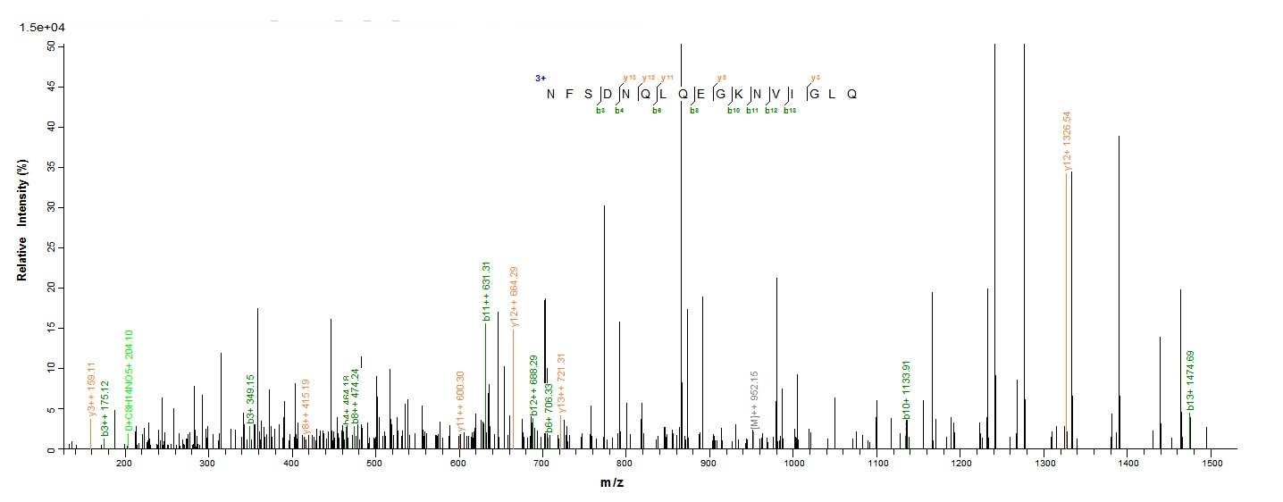 Human TAGLN2 protein