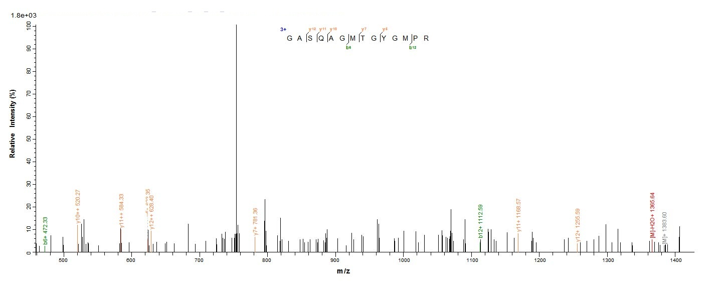 Human TAGLN2 protein