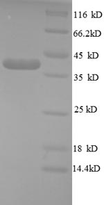 Human TDGF1 protein