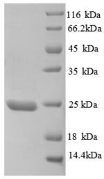 Human TIMP3 protein