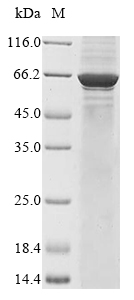 Human TKT protein