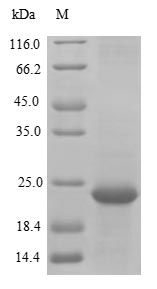 Primate TMEM168 protein