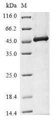 Human TMPRSS2 protein