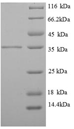 Human TMSB protein