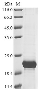 Human TRBC2 protein
