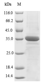 Human XRCC5 protein