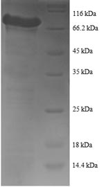 Human YARS protein
