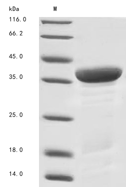 Human YWHAZ protein
