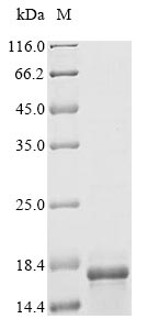 Parasite LDBPK_361420 protein