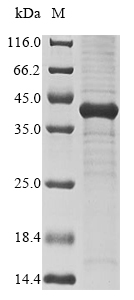 Human MIG7 protein