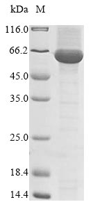 Virus Turnip mosaic virus Polyprotein protein