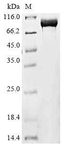 Virus Acinetobacter baumannii 29 kDa outer membrane protein protein