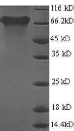 Virus ureB protein