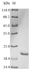 Gallus Bubalus bubalis Lingual antimicrobial peptide protein