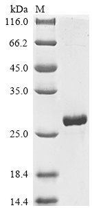 Plant viral diarrhea virus Genome polyprotein protein