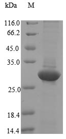 Virus Ceratopteris richardii Cyanovirin-N homolog protein