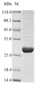 Virus Haplopelma schmidti Tau-theraphotoxin-Hs1a protein