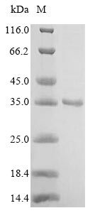Virus Enterobacteria phage T6 Beta-glucosyl-HMC-alpha-glucosyl-transferase protein