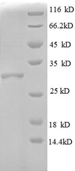 E. coli rpmD protein