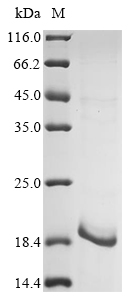 Virus vpr protein