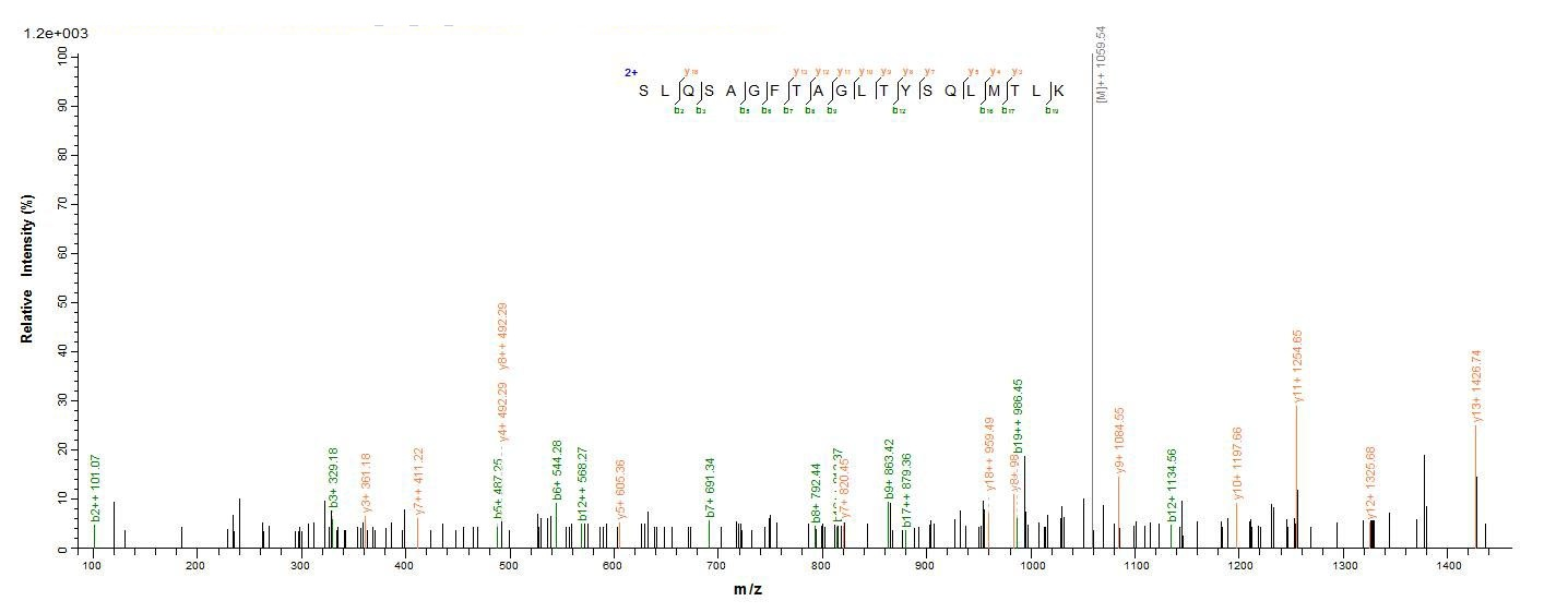 Virus Lassa virus Nucleoprotein(N) protein