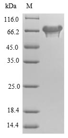 E. coli nadB protein