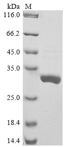 Virus Sandfly fever sicilian virus Nucleoprotein(N) protein
