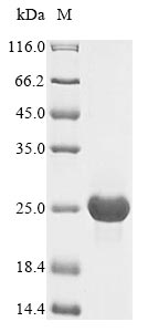 Virus UL128 protein