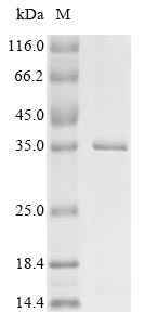 Virus NS1 protein