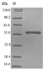 Virus M protein