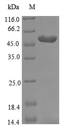 Bacteria Lactobacillus paracasei D-2-hydroxyisocaproate dehydrogenase protein