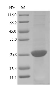 Virus Porcine parvovirus Capsid protein VP1 protein