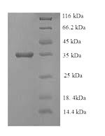 E. coli eutC protein