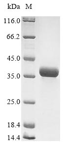 Virus A Outer capsid glycoprotein VP7 protein
