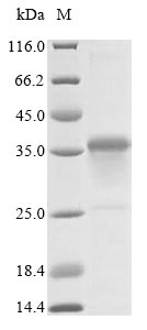 Bacteria Plasmodium falciparum Erythrocyte-binding antigen 175 protein