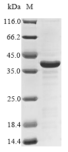 Virus GP protein