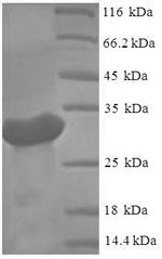Virus genotype 1a Genome polyprotein protein