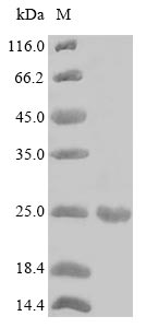 Plant Alnus glutinosa Major pollen allergen Aln g 1 protein