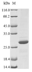 E. coli yjbL protein