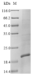 E. coli ubiC protein