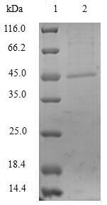 Virus Serratia marcescens Metallo-beta-lactamase type 2 protein