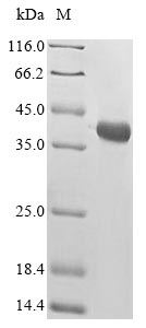 Reptile Bungarus multicinctus Alpha-bungarotoxin isoform A31 protein